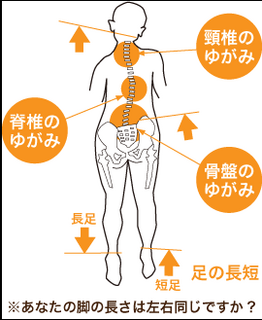 骨盤のゆがみとは仙腸関節のズレ 腰痛治療してもなかなか治らない人 腰痛予防対策マニュアル